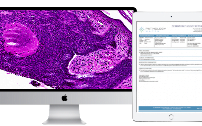 From Microscope to Monitor: 3 Ways Digital Pathology Is Improving Dermatology Practices