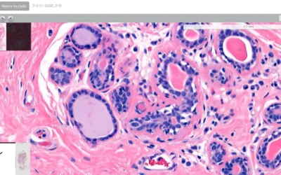 Introducing the Digital Dermatopathology Digest: A Three-Minute Dermatopathology Review Video Series