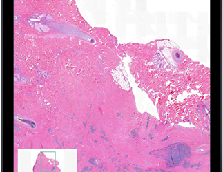 3 Benefits of Using Digital Pathology Services