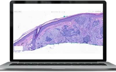 New CPT Codes Could Lead to Reimbursements for Digital Pathologists